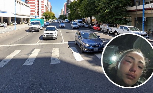 Joven herida tras intento de robo en Colón y Santa Fe