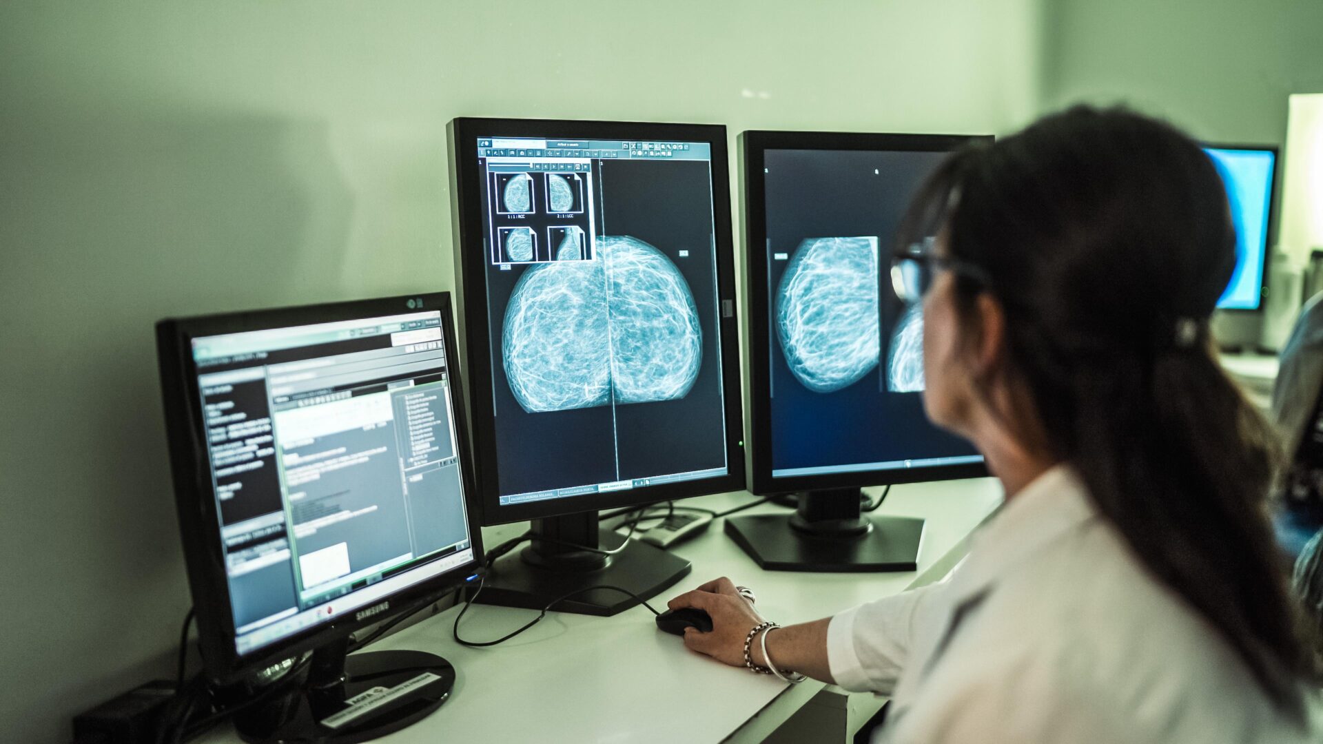 Jornada gratuita sobre cáncer de mama en Mendoza y Garay